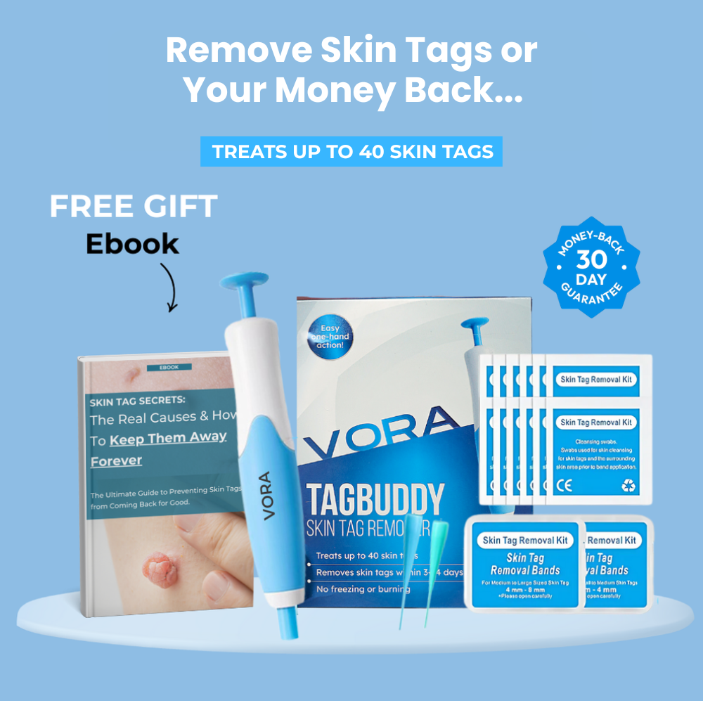 TaggyMax – No More Skin Tags