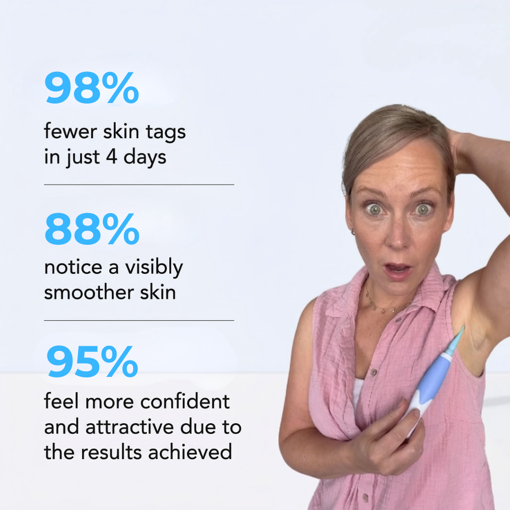 TaggyMax – No More Skin Tags